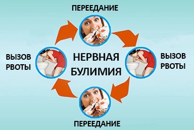 Лечение булимии в Северном